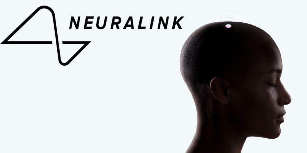 Elon Musk’s Brain Implant Business, Neuralink, Discreetly Raises An Extra  Million